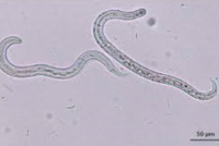 „Crenosoma vulpis“, Mikroskopaufnahme